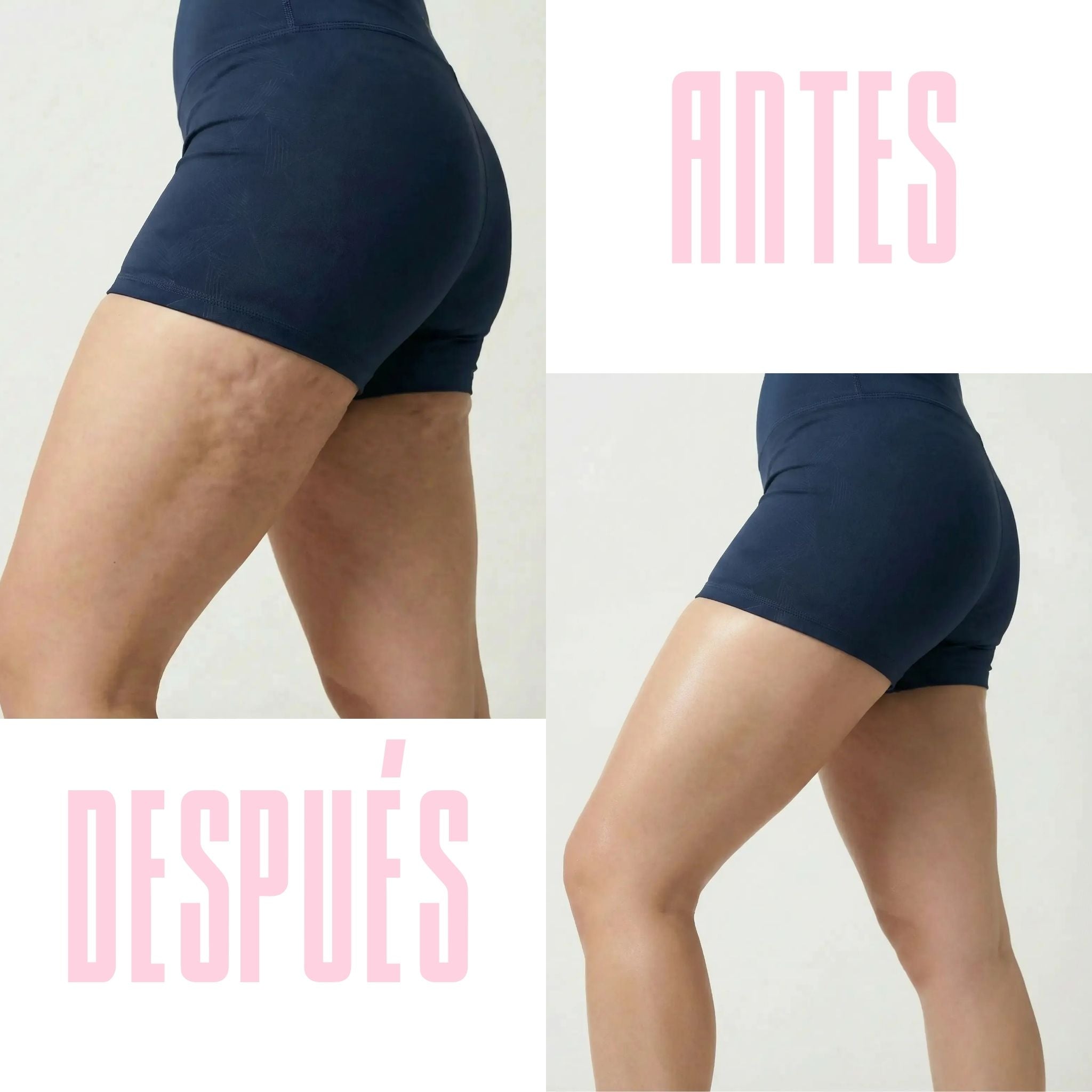 MASAJEADOR ANTICELULÍTICO